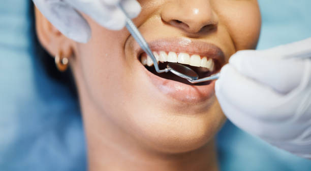 Best Emergency Dental Extractions in Dickson, OK