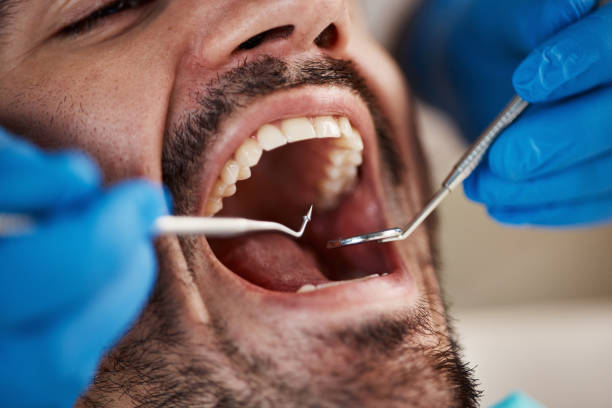 Best Emergency Root Canal Treatment in Dickson, OK